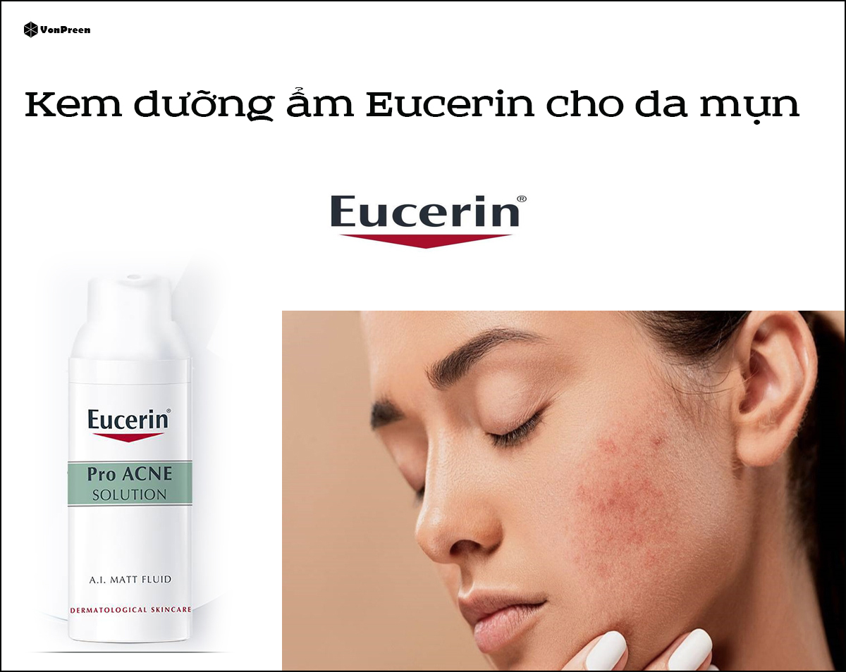 Kem dưỡng ẩm Eucerin cho da mụn đáng để mua nhất hiện nay.ADD